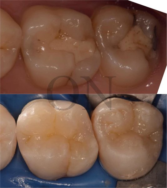 OnDental Microscope Dentistry